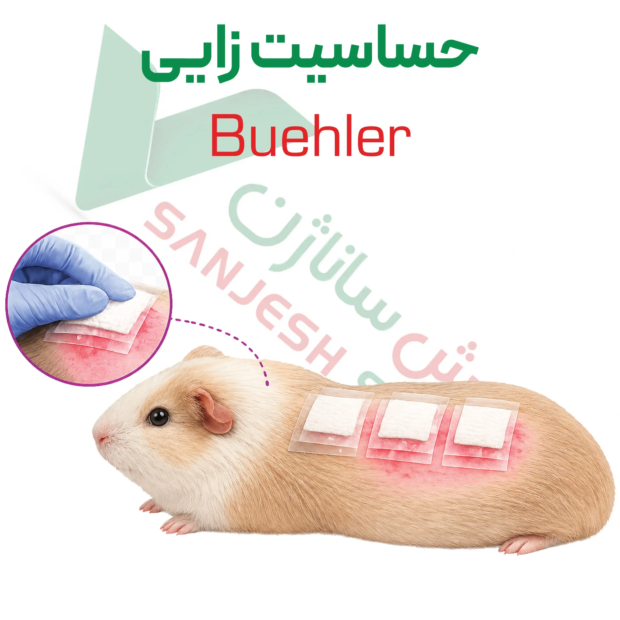 آزمون حساسیت زایی پوستی – پچ بسته (Buehler)
