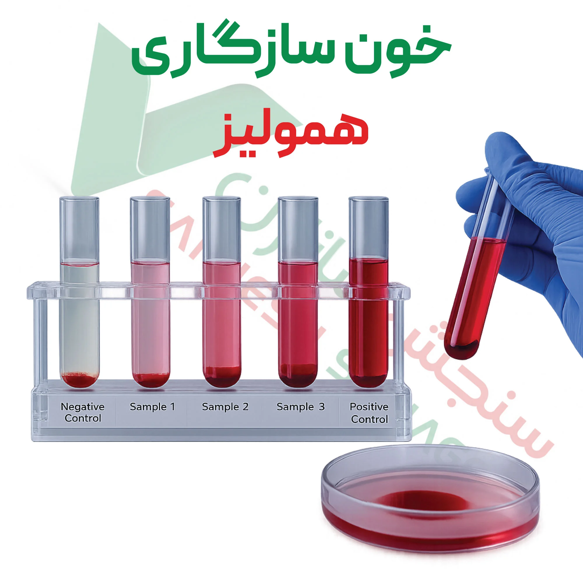 آزمون خون سازگاری- همولیز