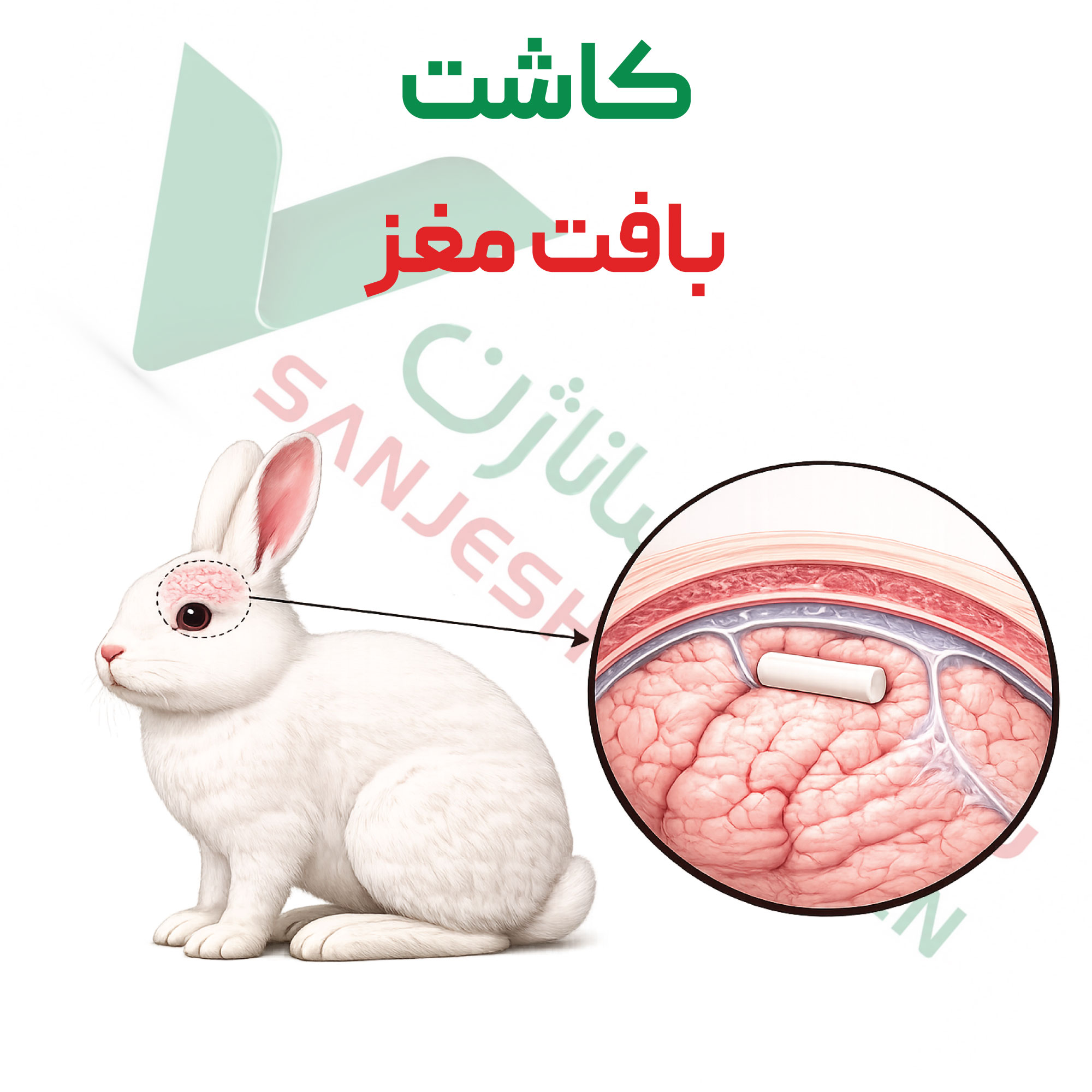 تست کاشت-مغزی